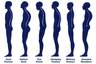 Posture Correction